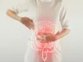 Une femme se tient la zone abdominale, où une illustration du côlon est superposée, suggérant une gêne liée à la constipation chronique.