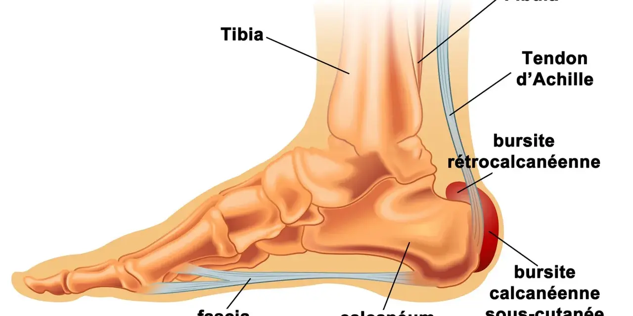 Anatomie du pied montrant le tendon d'Achille, le calcanéum et le fascia plantaire. Un remède de grand-mère pour la tendinite du tendon d'Achille pourrait soulager ces zones.