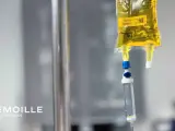 Sérum de glutathion en perfusion, une pratique esthétique qui peut présenter un danger si mal encadrée.