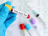 Main tenue un tube à essai étiqueté "Folic Acid Test", prêt pour l'analyse des folates sériques.