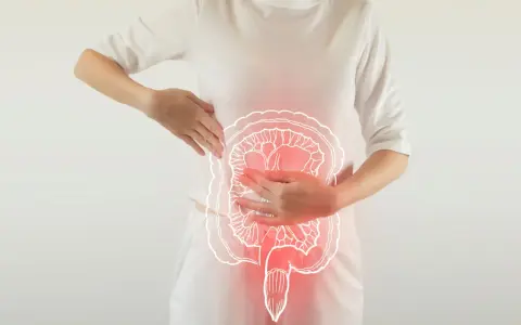 Une femme se tient la zone abdominale, où une illustration du côlon est superposée, suggérant une gêne liée à la constipation chronique.