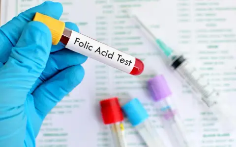 Main tenue un tube à essai étiqueté "Folic Acid Test", prêt pour l'analyse des folates sériques.