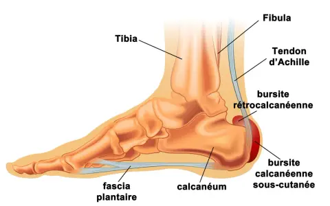Anatomie du pied montrant le tendon d'Achille, le calcanéum et le fascia plantaire. Un remède de grand-mère pour la tendinite du tendon d'Achille pourrait soulager ces zones.