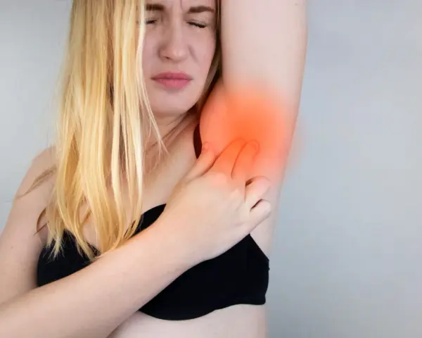 Une femme blonde exprime une douleur vive à l'aisselle, se tenant le bras avec une expression de souffrance.