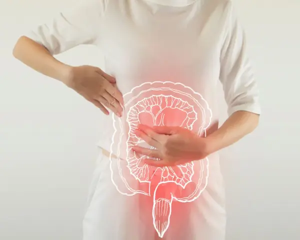 Une femme se tient la zone abdominale, où une illustration du côlon est superposée, suggérant une gêne liée à la constipation chronique.