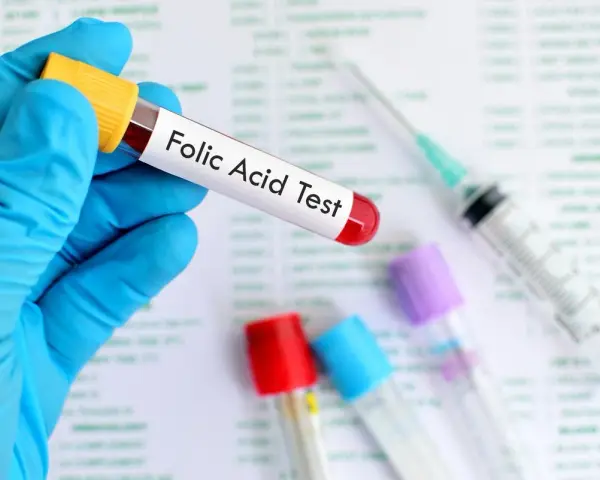 Main tenue un tube à essai étiqueté "Folic Acid Test", prêt pour l'analyse des folates sériques.