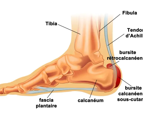 Anatomie du pied montrant le tendon d'Achille, le calcanéum et le fascia plantaire. Un remède de grand-mère pour la tendinite du tendon d'Achille pourrait soulager ces zones.