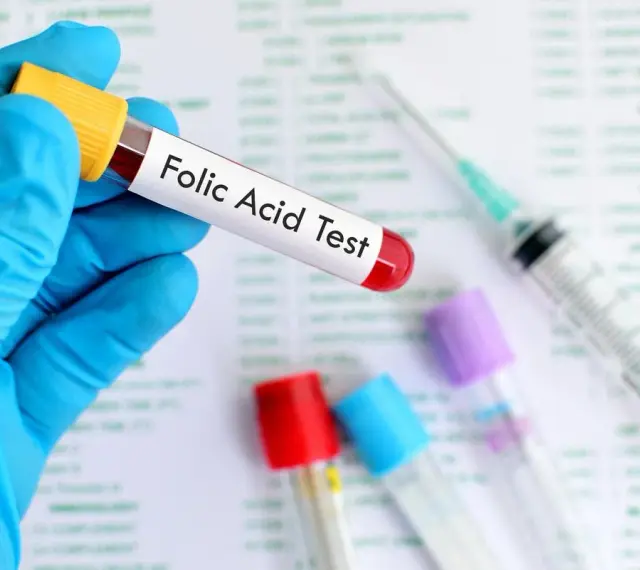 Main tenue un tube à essai étiqueté "Folic Acid Test", prêt pour l'analyse des folates sériques.