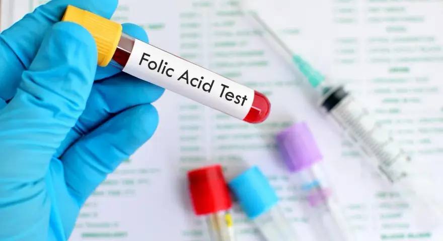Main tenue un tube à essai étiqueté "Folic Acid Test", prêt pour l'analyse des folates sériques.