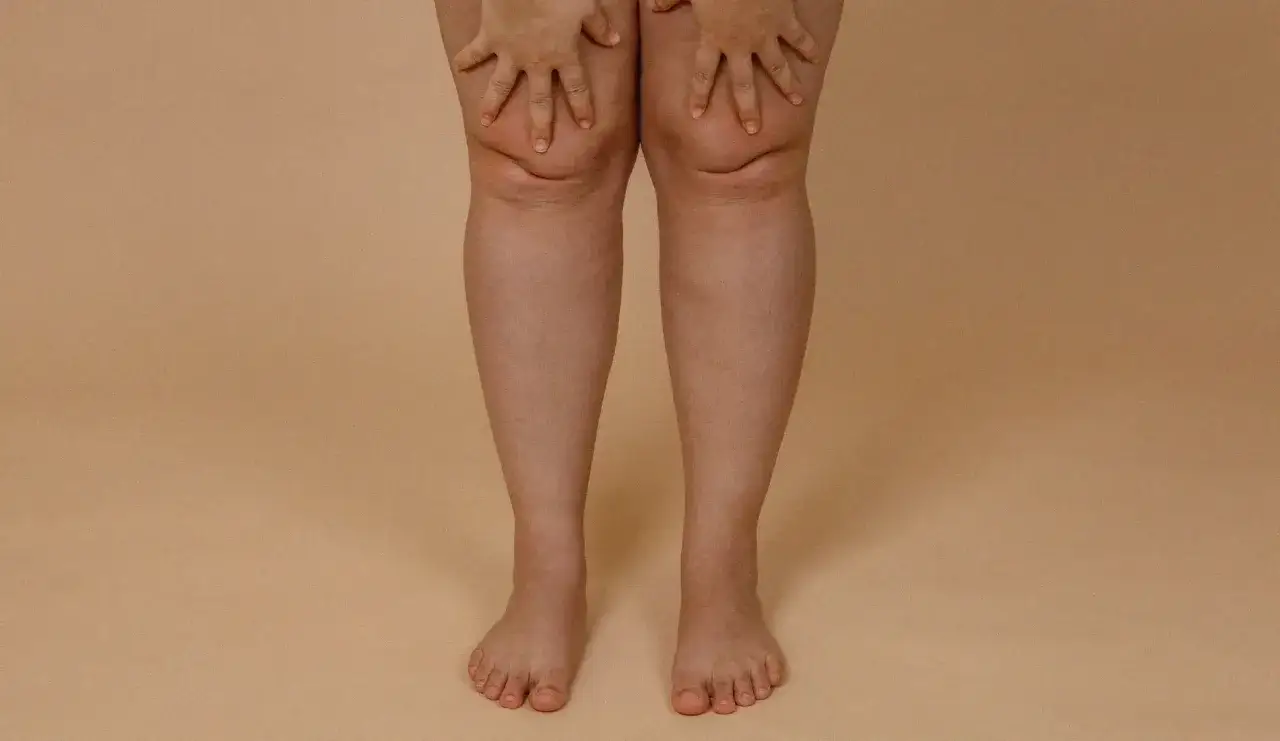 Les mains caressent les genoux, où l'on peut voir une légère rétention d'eau dans les jambes. Les pieds nus reposent sur un fond beige.