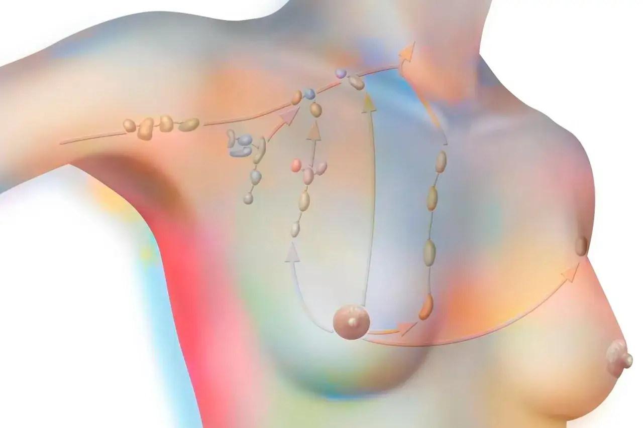 Sch&eacute;ma des ganglions lymphatiques du sein et de l'aisselle, illustrant le drainage lymphatique. Une douleur aisselle peut &ecirc;tre li&eacute;e &agrave; ces voies.