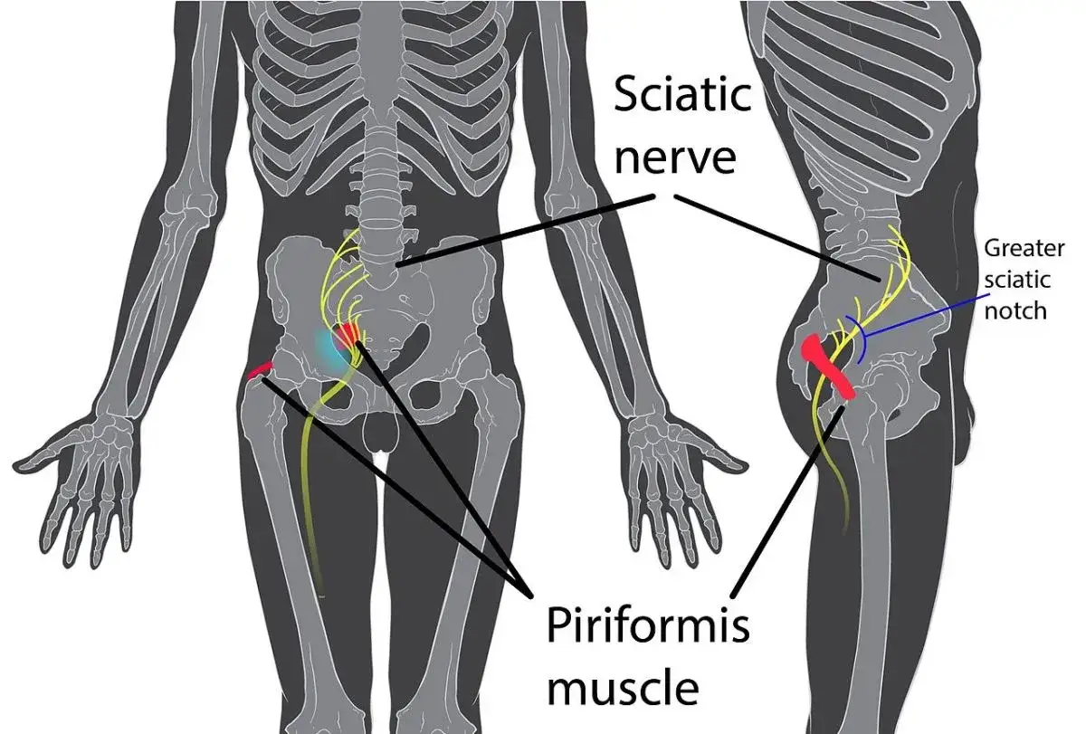 Anatomie du nerf sciatique et du muscle piriforme, expliquant les causes des douleurs dans les jambes et les cuisses.